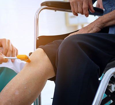 Bone Distractors Market by Product, Type, and Geography - Global Forecast and Analysis 2019-2023 